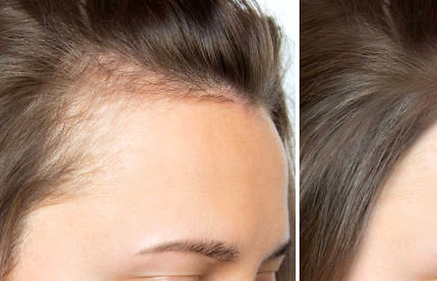 Hair & Scalp category image
